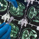 Image for article titled Frightening New Details Emerge About Mystery Brain Illness in Canada
